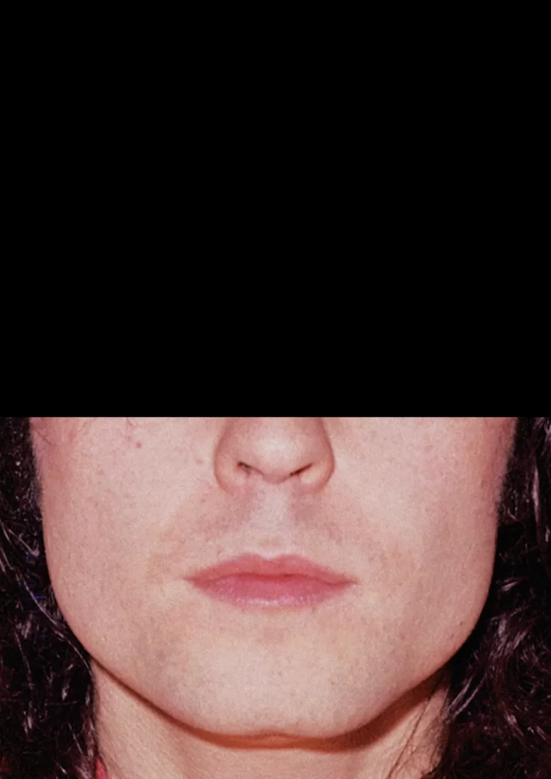 Foto de Marc Bolan tirada pelo fotógrafo Alec Byrne em 1971. Por cima da parte superior do rosto do artista (acima do nariz) uma tarja preta.